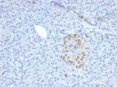 Immunohistochemistry-Paraffin: NKX6.1 Antibody (NKX61/2561) - Azide and BSA Free [NBP2-79872]