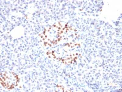 Immunohistochemistry-Paraffin: NKX6.1 Antibody (NKX61/2561) [NBP2-79737]