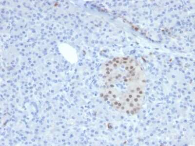 Immunohistochemistry-Paraffin: NKX6.1 Antibody (NKX61/2561) [NBP2-79737]