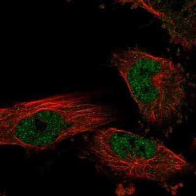 Immunocytochemistry/ Immunofluorescence: NKX6.1 Antibody [NBP1-82553]