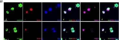 Immunocytochemistry/ Immunofluorescence: NKX6.1 Antibody [NBP1-82553]