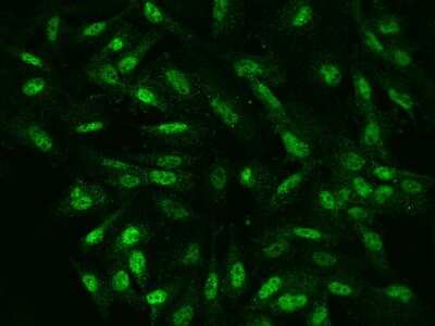 Immunocytochemistry/ Immunofluorescence: NKX6.1 Antibody [NBP2-97468]