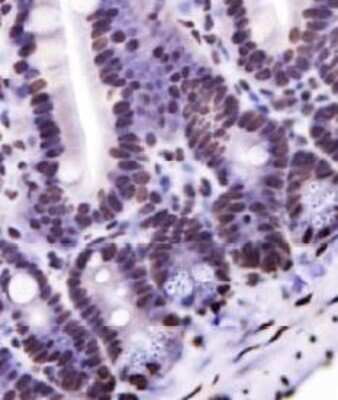 Immunohistochemistry: NKX6.1 Antibody - BSA Free [NBP1-49672]