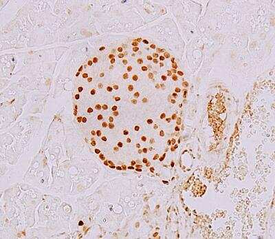 Immunohistochemistry-Paraffin: NKX6.1 Antibody - BSA Free [NBP1-49672]