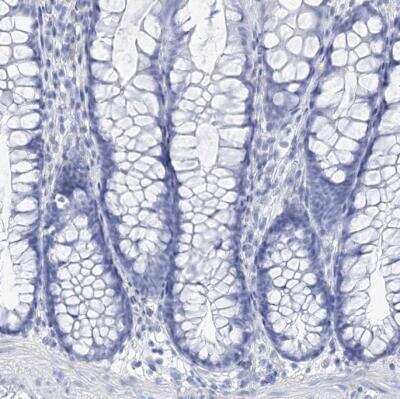 Immunohistochemistry-Paraffin: NKX6.1 Antibody [NBP1-82553]