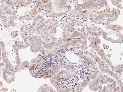 Immunohistochemistry-Paraffin: NKX6.1 Antibody [NBP2-99125]