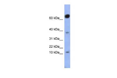 Western Blot: NKX6.3 Antibody [NBP2-83281]