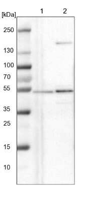 Western Blot: NLE1 Antibody [NBP1-83860]