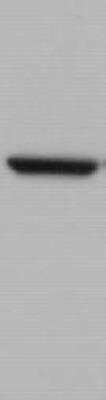 Western Blot: NLK Antibody (1C1) [H00051701-M01]