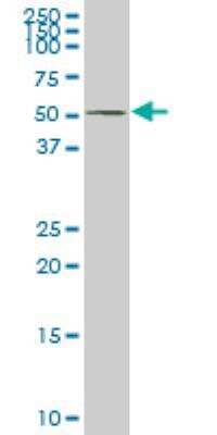 Western Blot: NLK Antibody (2B11) [H00051701-M02]