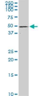 Western Blot: NLK Antibody (2B11) [H00051701-M02]