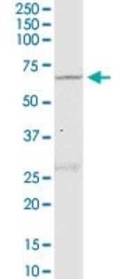 Western Blot: NLK Antibody (2B11) [H00051701-M02]