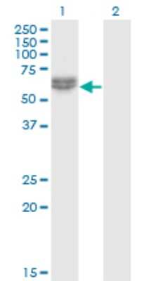 Western Blot: NLK Antibody (2B11) [H00051701-M02]