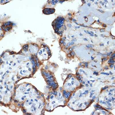 Immunohistochemistry-Paraffin: NLK Antibody (6G5V10) [NBP3-15728]