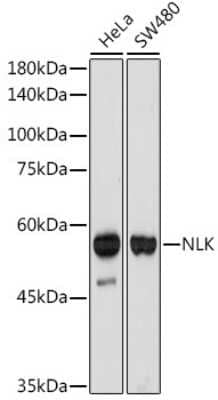 Western Blot: NLK Antibody (6G5V10) [NBP3-15728]