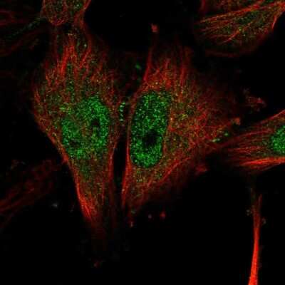 Immunocytochemistry/ Immunofluorescence: NLK Antibody [NBP2-56662]