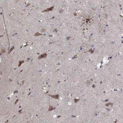 Immunohistochemistry: NLK Antibody [NBP2-56662]