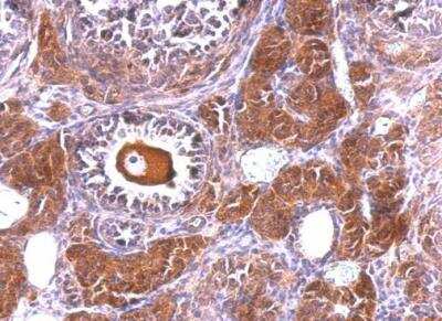 Immunohistochemistry-Paraffin: NLK Antibody [NBP1-32264]