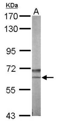 Western Blot: NLK Antibody [NBP1-32264]