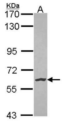 Western Blot: NLK Antibody [NBP1-32264]