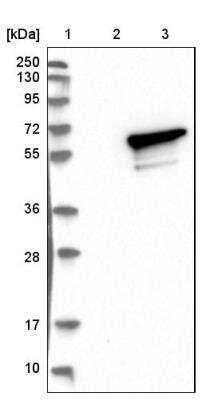 Western Blot: NLK Antibody [NBP1-86047]