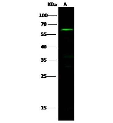 Western Blot: NLK Antibody [NBP2-99830]