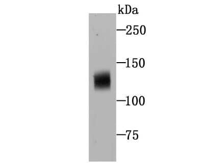 Western Blot: NLRC3 Antibody [NBP2-75593]