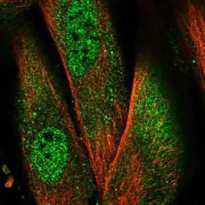 Immunocytochemistry/ Immunofluorescence: NLRP1/NALP1 Antibody [NBP2-57196]