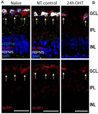 Immunohistochemistry: NLRP1/NALP1 Antibody [NB100-56148]