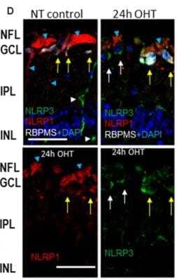 Immunohistochemistry: NLRP1/NALP1 Antibody [NB100-56148]