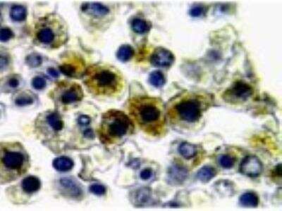 Immunohistochemistry-Paraffin: NLRP1/NALP1 Antibody [NB100-56147]