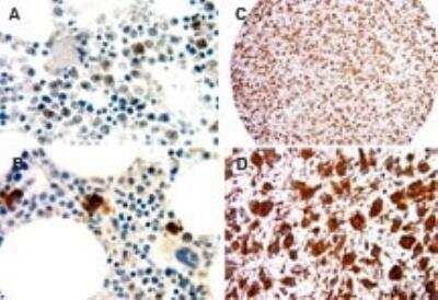 Immunohistochemistry-Paraffin: NLRP1/NALP1 Antibody [NB100-56148]