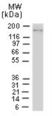 Immunoprecipitation: NLRP1/NALP1 Antibody [NB100-56147]