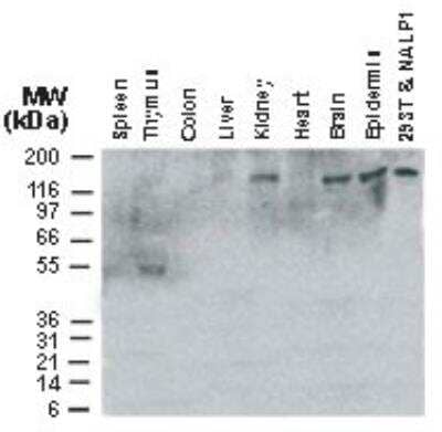 Western Blot: NLRP1/NALP1 Antibody [NB100-56148]