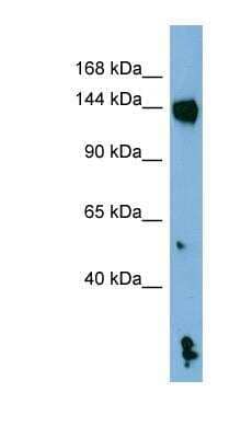 Western Blot: NLRP1/NALP1 Antibody [NBP1-54899]