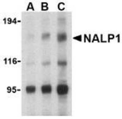 Western Blot: NLRP1/NALP1 AntibodyBSA Free [NBP1-76656]