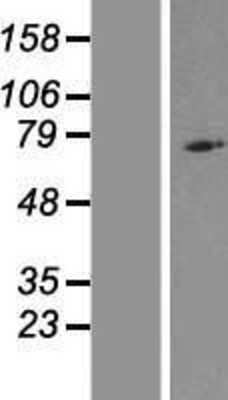 Western Blot: NLRP10/Pynod/NALP10 Overexpression Lysate [NBL1-13672]