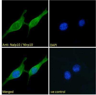 Immunofluorescence: NLRP10/Pynod/NALP10 Antibody [NBP2-76809]