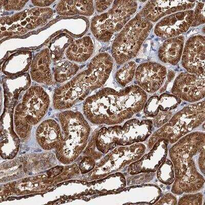 Immunohistochemistry-Paraffin: NLRP10/Pynod/NALP10 Antibody [NBP1-85556]