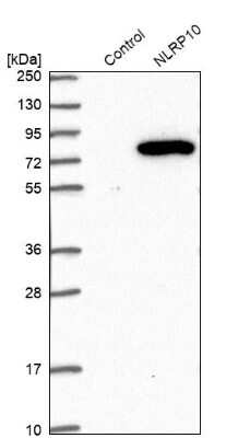 Western Blot: NLRP10/Pynod/NALP10 Antibody [NBP1-85557]