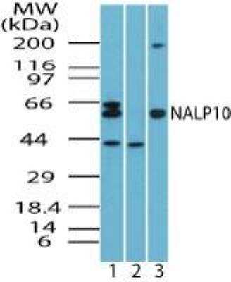 Western Blot: NLRP10/Pynod/NALP10 Antibody [NBP2-24606]