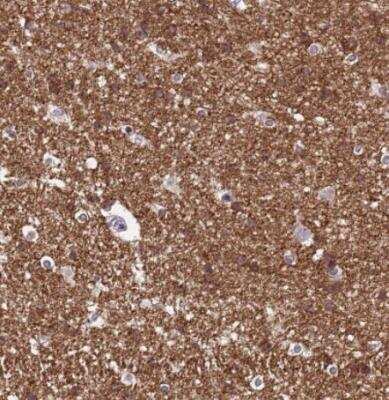 Immunohistochemistry-Paraffin: NLRP11 Antibody [NBP1-92186]