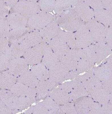 Immunohistochemistry-Paraffin: NLRP11 Antibody [NBP1-92186]