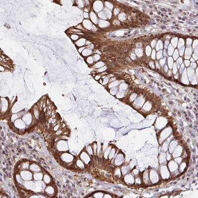 Immunohistochemistry-Paraffin: NLRP13 Antibody [NBP2-32546]