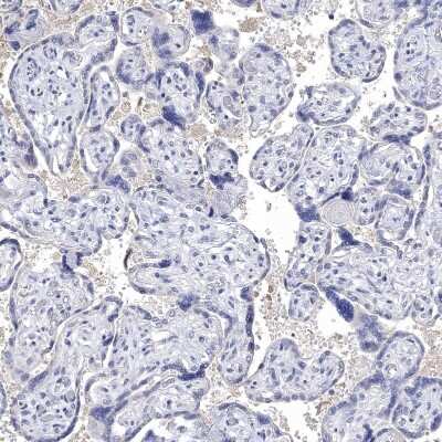Immunohistochemistry-Paraffin: NLRP14 Antibody [NBP1-90627]