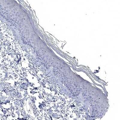 Immunohistochemistry-Paraffin: NLRP14 Antibody [NBP1-90627]