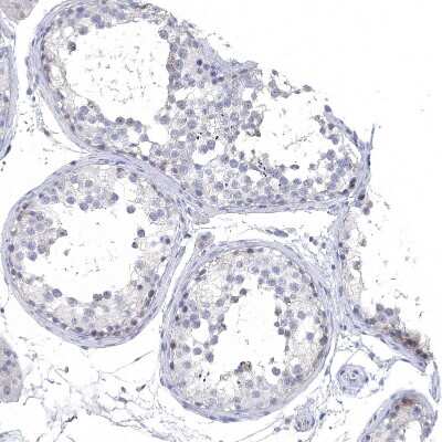 Immunohistochemistry-Paraffin: NLRP14 Antibody [NBP1-90627]