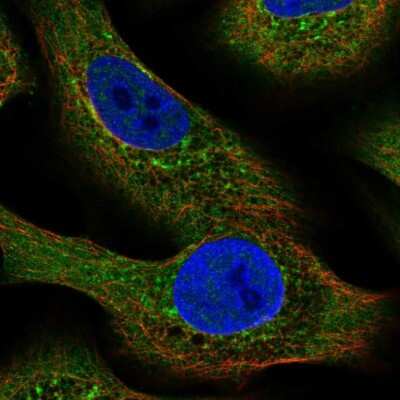 Immunocytochemistry/ Immunofluorescence: NLRP2/NALP2 Antibody [NBP2-58146]