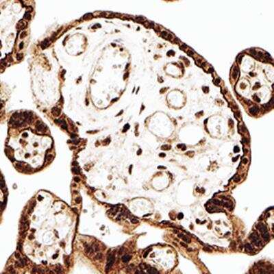Immunohistochemistry-Paraffin: NLRP2/NALP2 Antibody [NB100-56154]