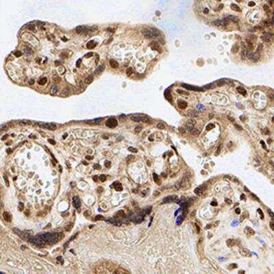 Immunohistochemistry-Paraffin: NLRP2/NALP2 Antibody [NB100-56155]